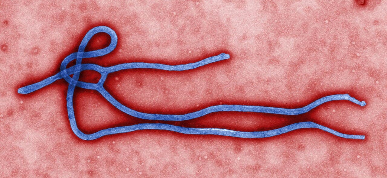Electron micrograph of Ebola virus particles